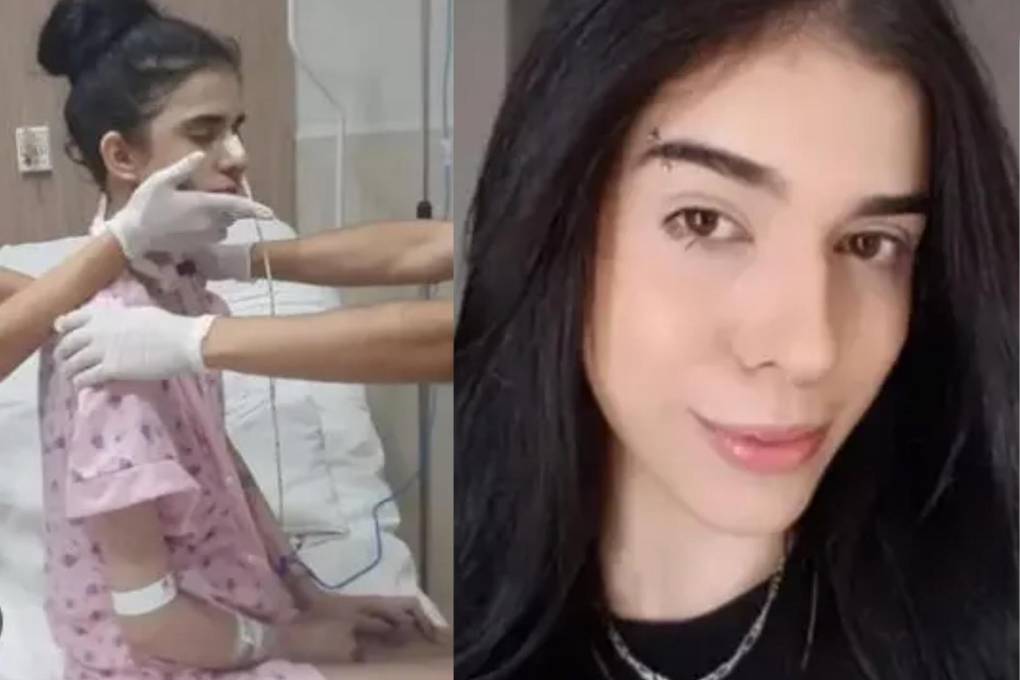 Una sufrió una inflamación en el cerebro por oler pimientos picantes