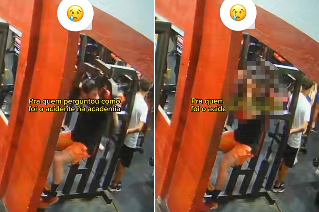 Un hombre se golpea la cabeza con la máquina de un gimnasio
