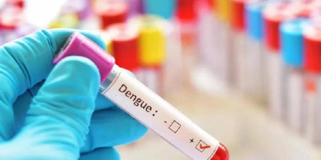 La prueba PCR de dengue en época de poca demanda demoraba alrededor de 8 horas