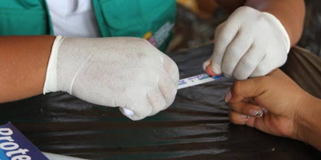 Las pruebas de detección de VIH son gratuitas en Bolivia