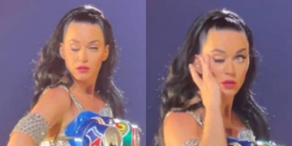¿Qué le pasó a Katy Perry en el ojo?, una experta lo explica