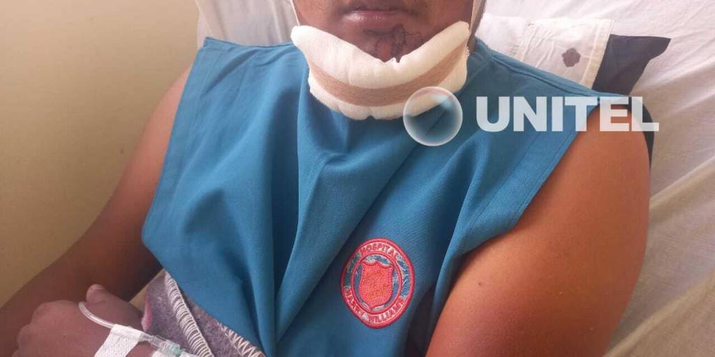 Jhonny Poma de 24 años, recibió un disparo en la mandíbula
