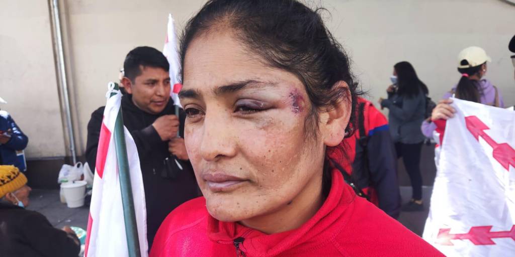 La mestra María Teresa Duran, representante del magisterio de Chuquisaca, muestras la herida de su rostro.