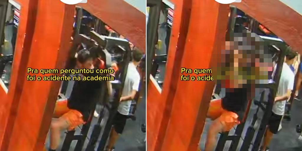 Un hombre se golpea la cabeza con la máquina de un gimnasio
