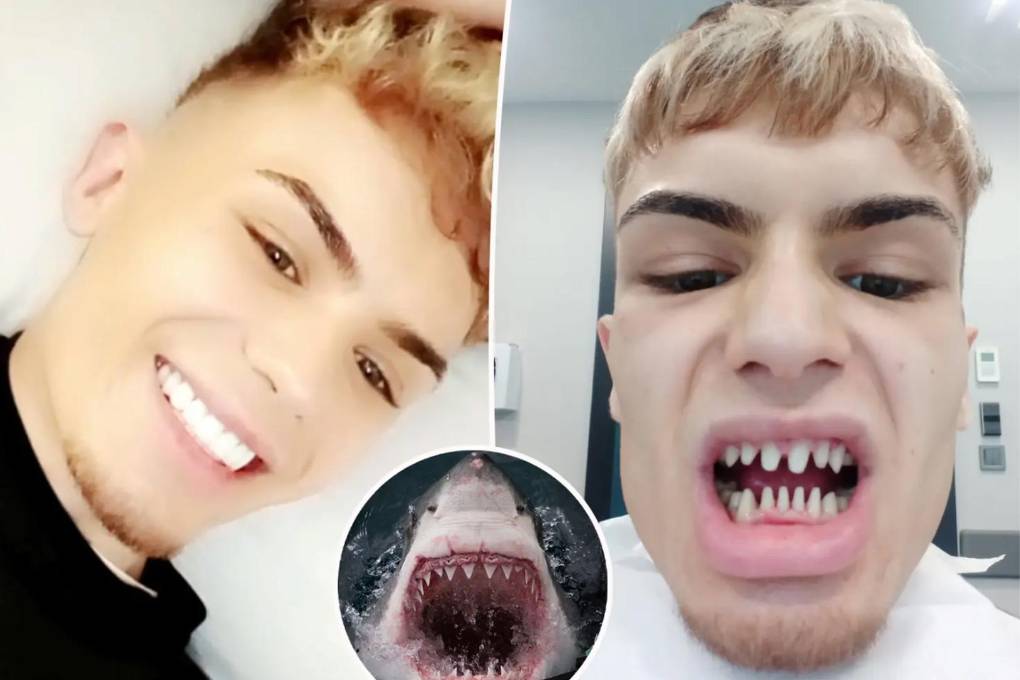 James, exhibió el antes y después de su tratamiento estético