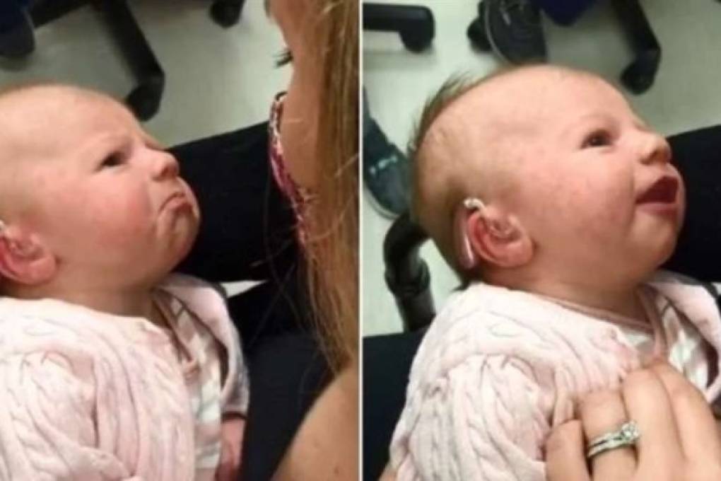La conmovedora reacción de una bebé con sordera al escuchar por primera vez la voz de su mamá