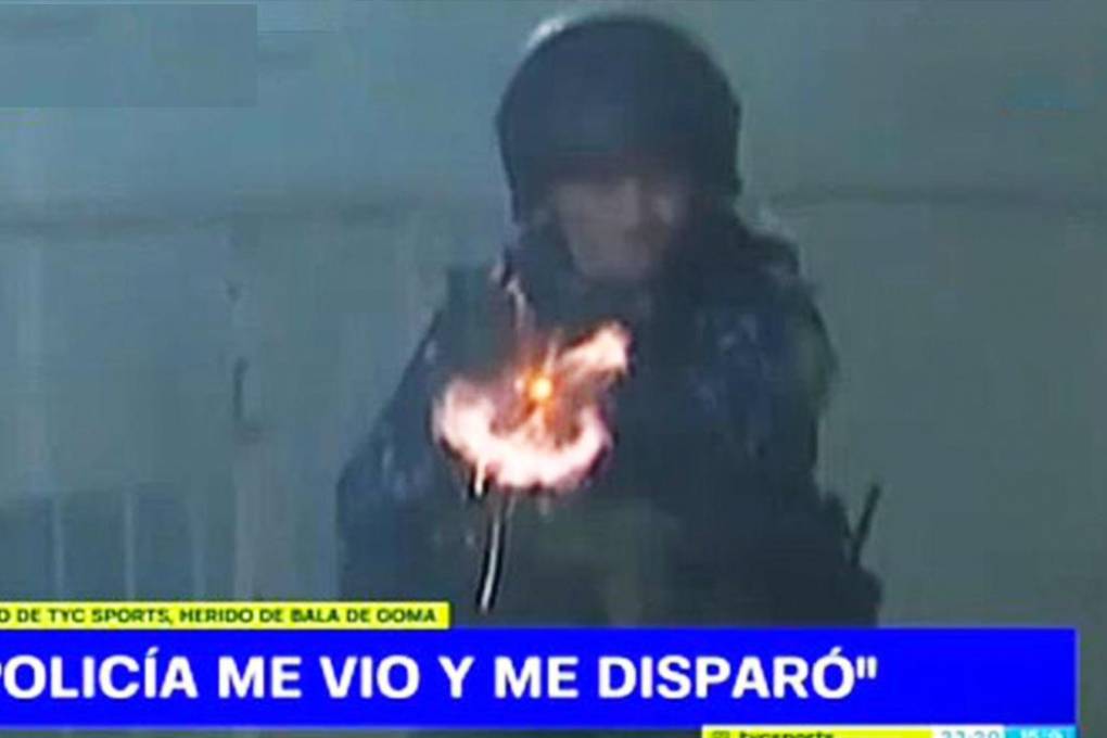 Un policía disparó contra un camarógrafo que cubría Gimnasia-Boca; hay molestia en la prensa argentina