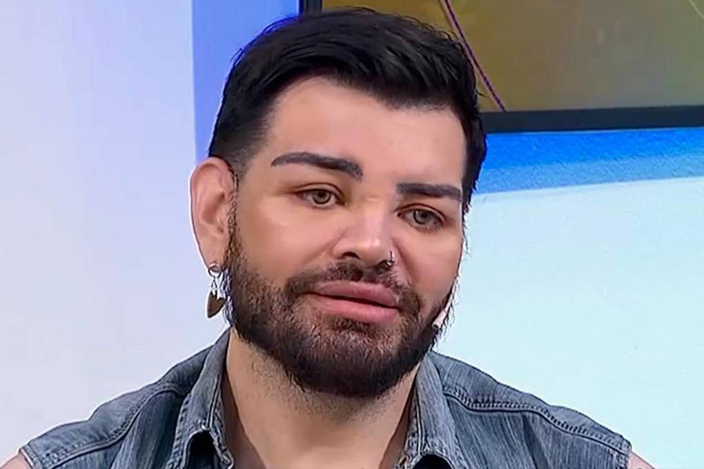 Fran Mariano, argentino que se operó para parecerse a Ricky Martin 