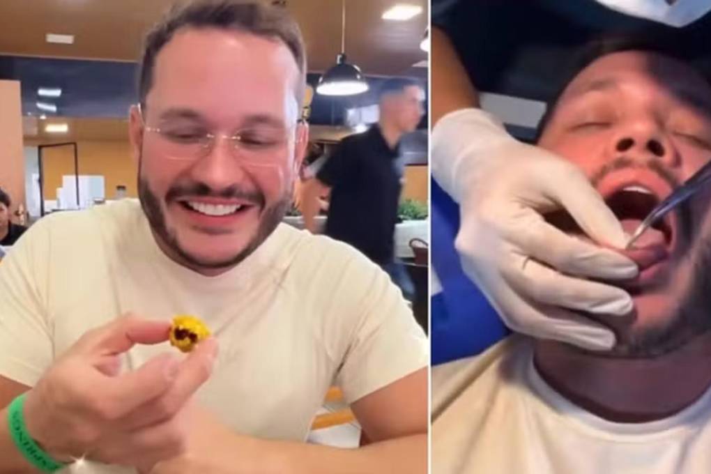 Un influencer quedó con 50 espinas en la lengua tras comer la fruta pequi