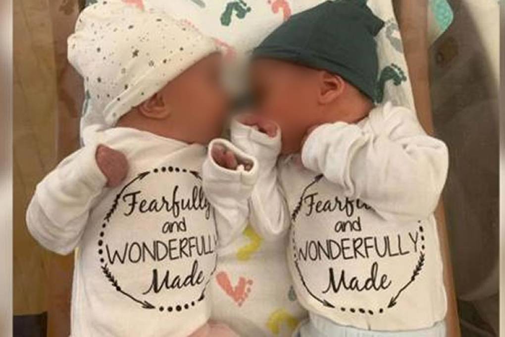Nacen con éxito un par de gemelos de embriones congelados hace 30 años