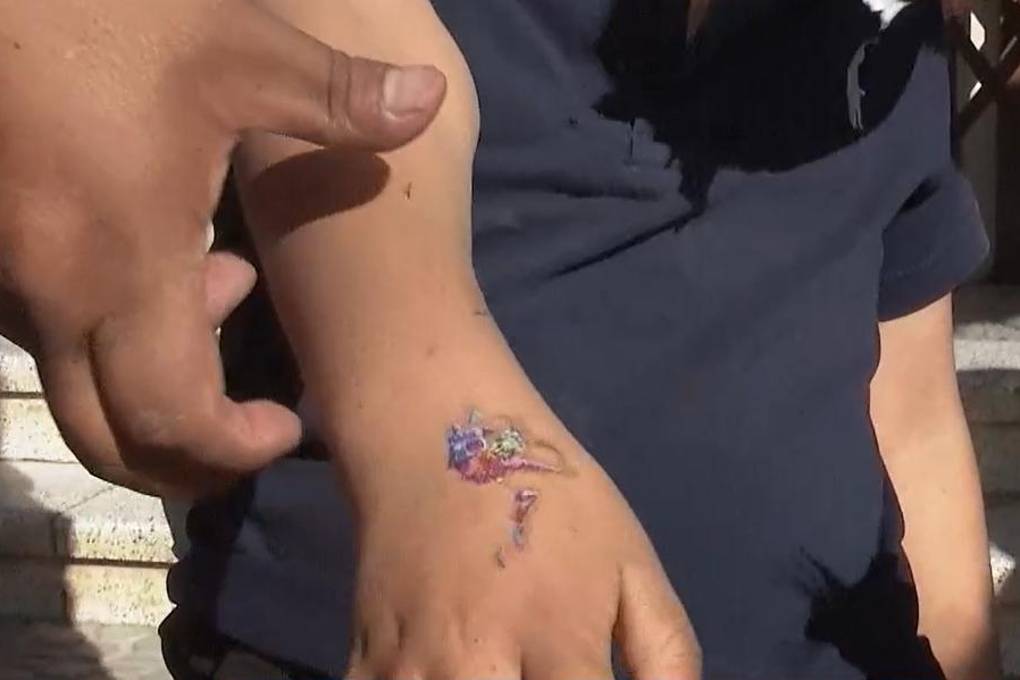 Menor tiene cortes en los brazos