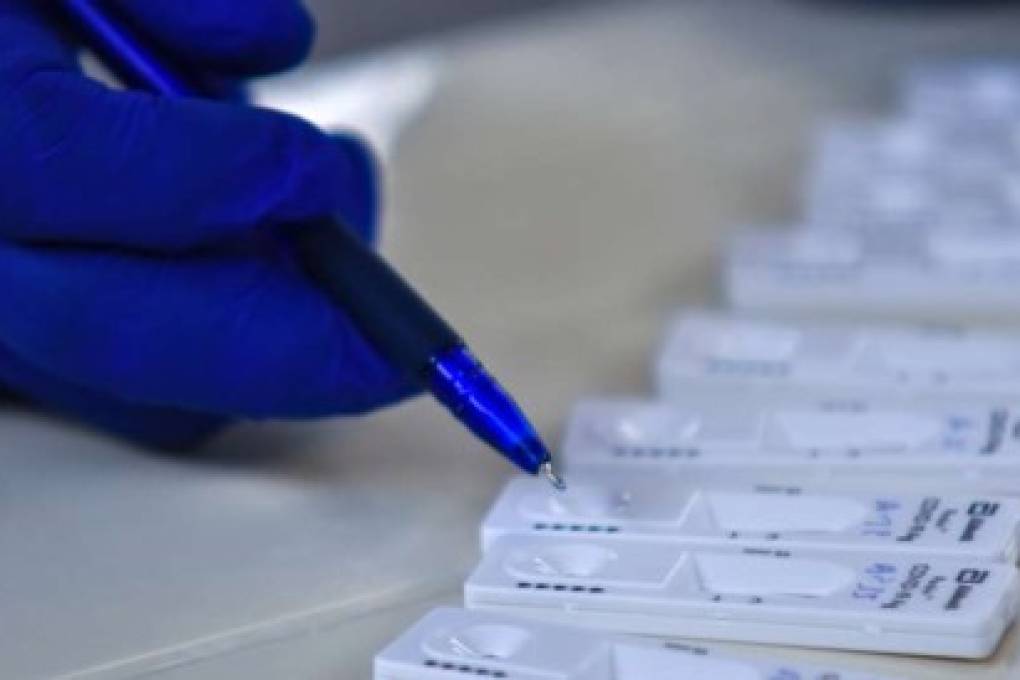 Por tercer día consecutivo Santa Cruz reporta más de mil casos de coronavirus