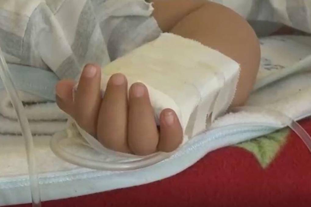 Un menor recibe suero en el Hospital de Niños de Santa Cruz.